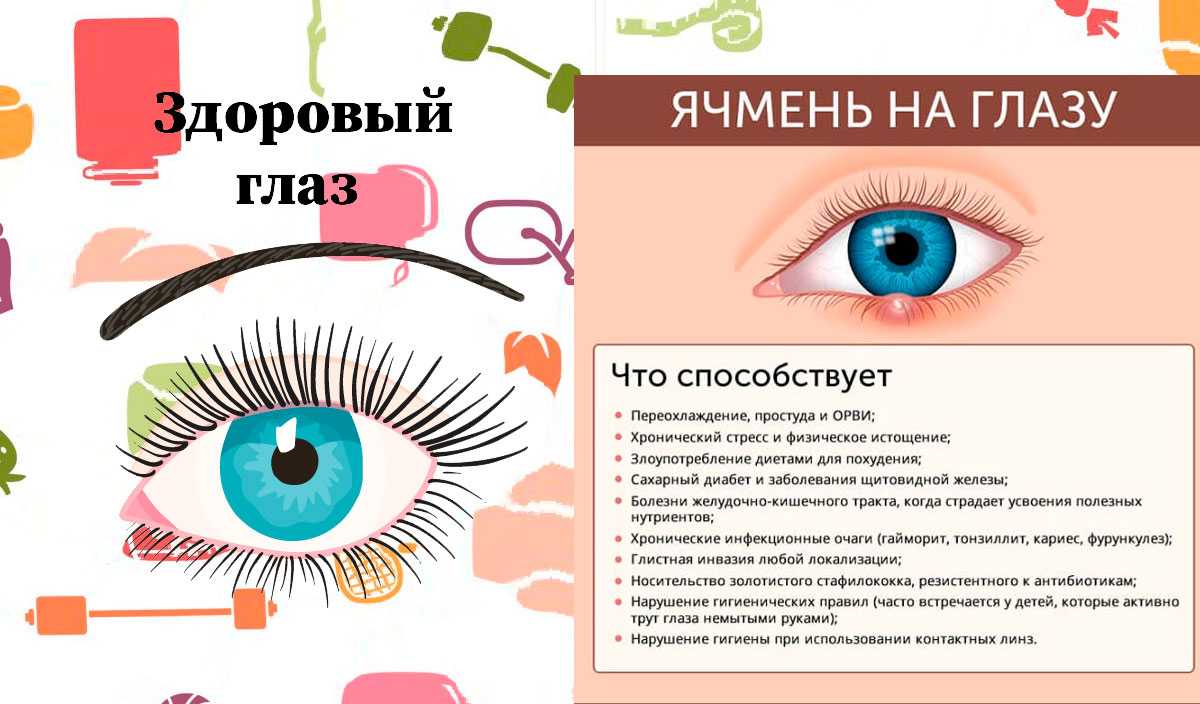 Психосоматика ячменя на правом и левом глазу: нервы как причина | мрикрнц.рф