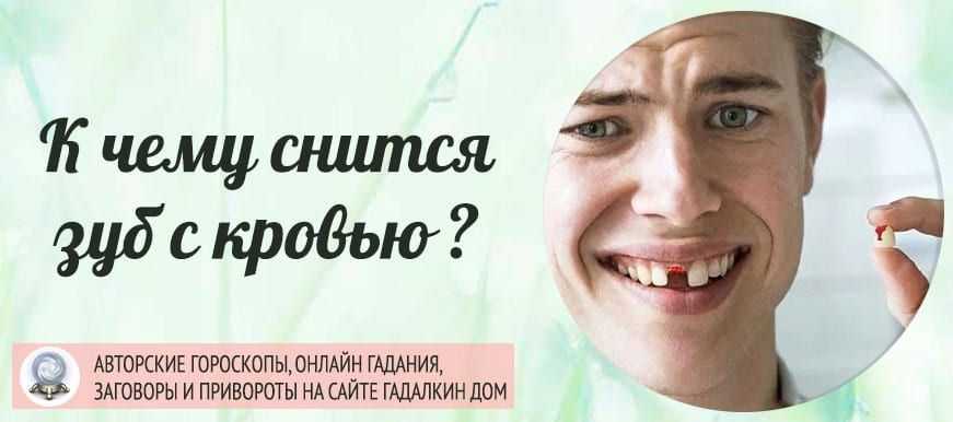 К чему снится, что выпадают зубы без крови — 47 значений сна