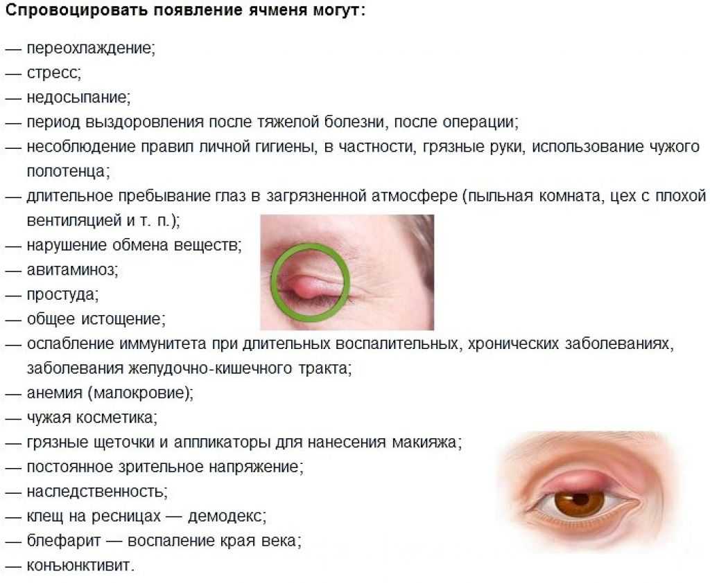 Заговор от ячменя