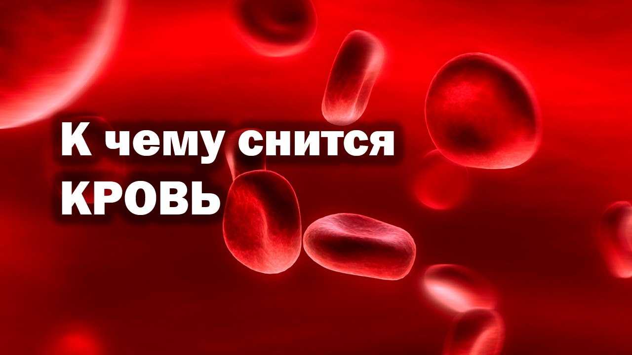 К чему снится много крови — топ 36 толкований по разным сонникам: что означает, если приснилось свое или чужое кровоизлияние на полу, на земле или на снегу